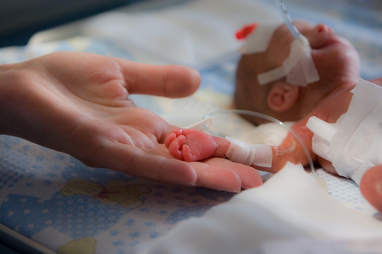 Minél kisebb, illetve minél betegebb egy baba, annál inkább szükséges, hogy korszerű, nagytudású preciziós gépek segítsék gyógyítását